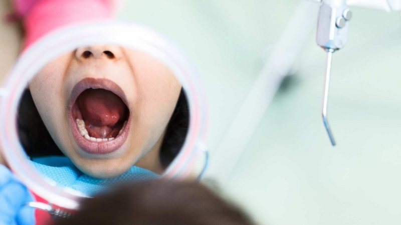 Children’s Oral Health Deteriorating Due To Covid Focus: Can Dentists Help?