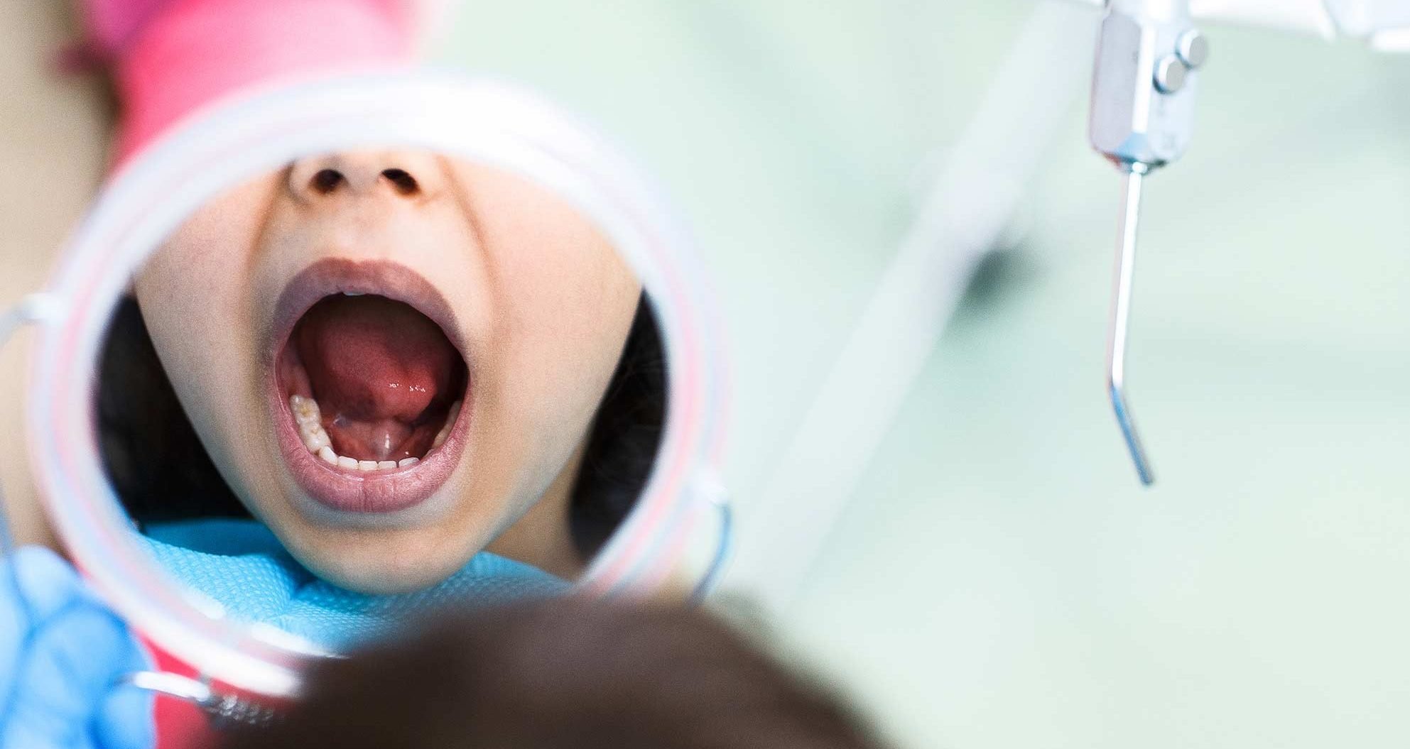 Children’s Oral Health Deteriorating Due To Covid Focus: Can Dentists Help?