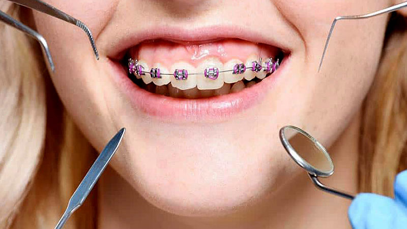 5 Reasons to choose Orthodontic treatment by a dentist
