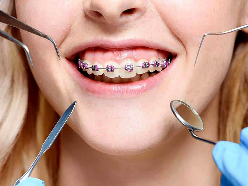 5 Reasons to choose Orthodontic treatment by a dentist